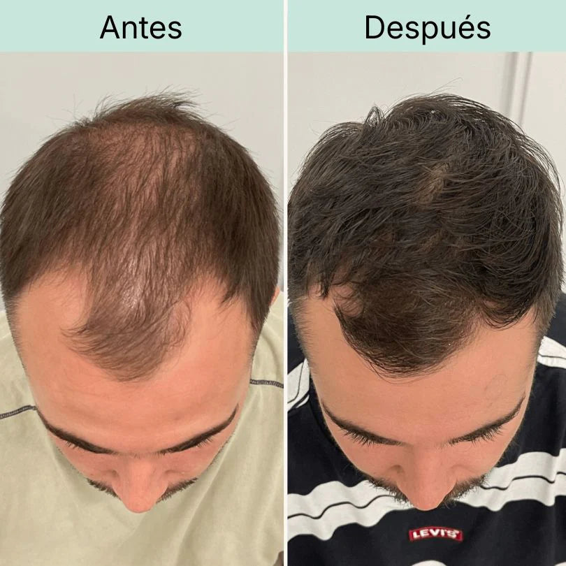 Zona dos bilhetes