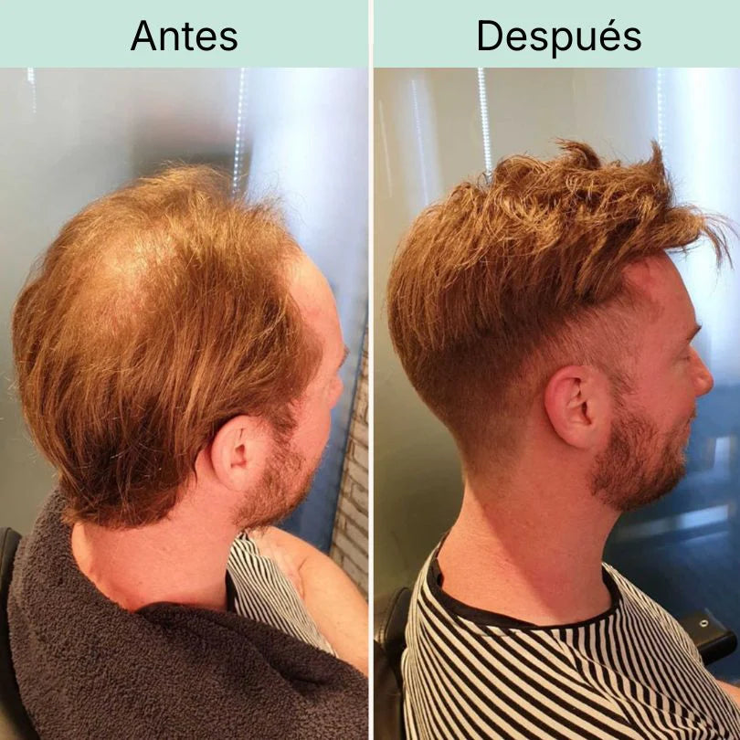 Coroa e nuca
