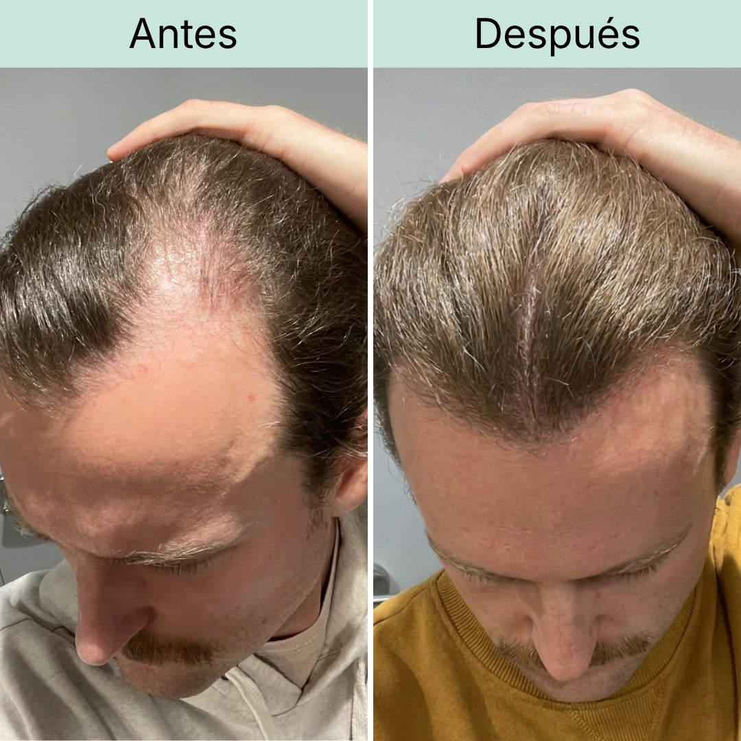Zona dos bilhetes