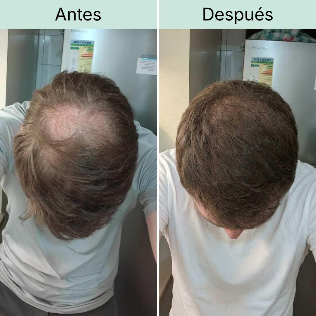 Zona superior