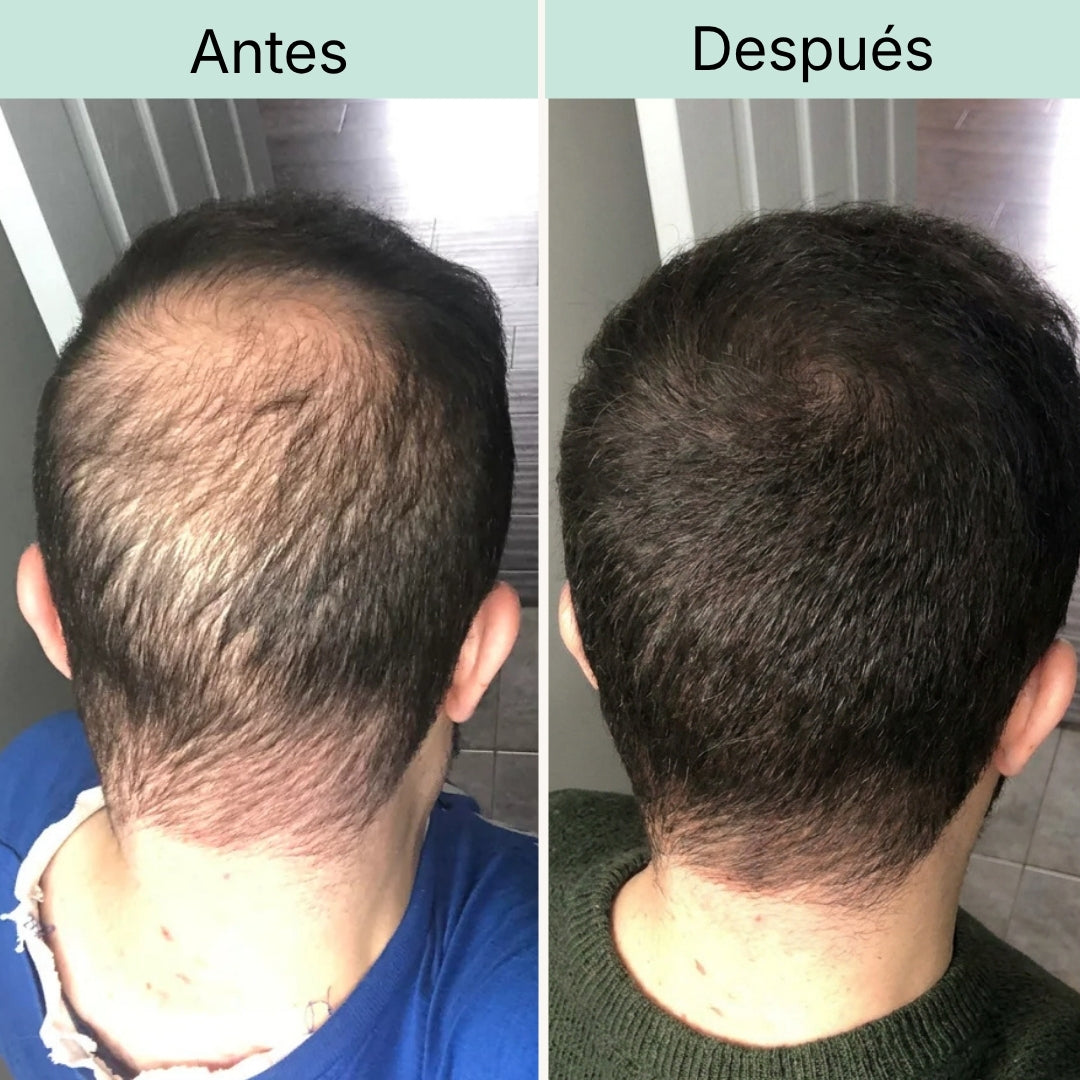Coroa e nuca