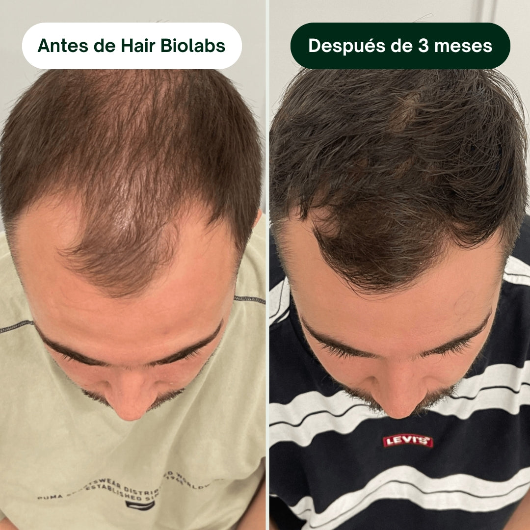 Serum Anticaída para hombre - Hair Biolabs