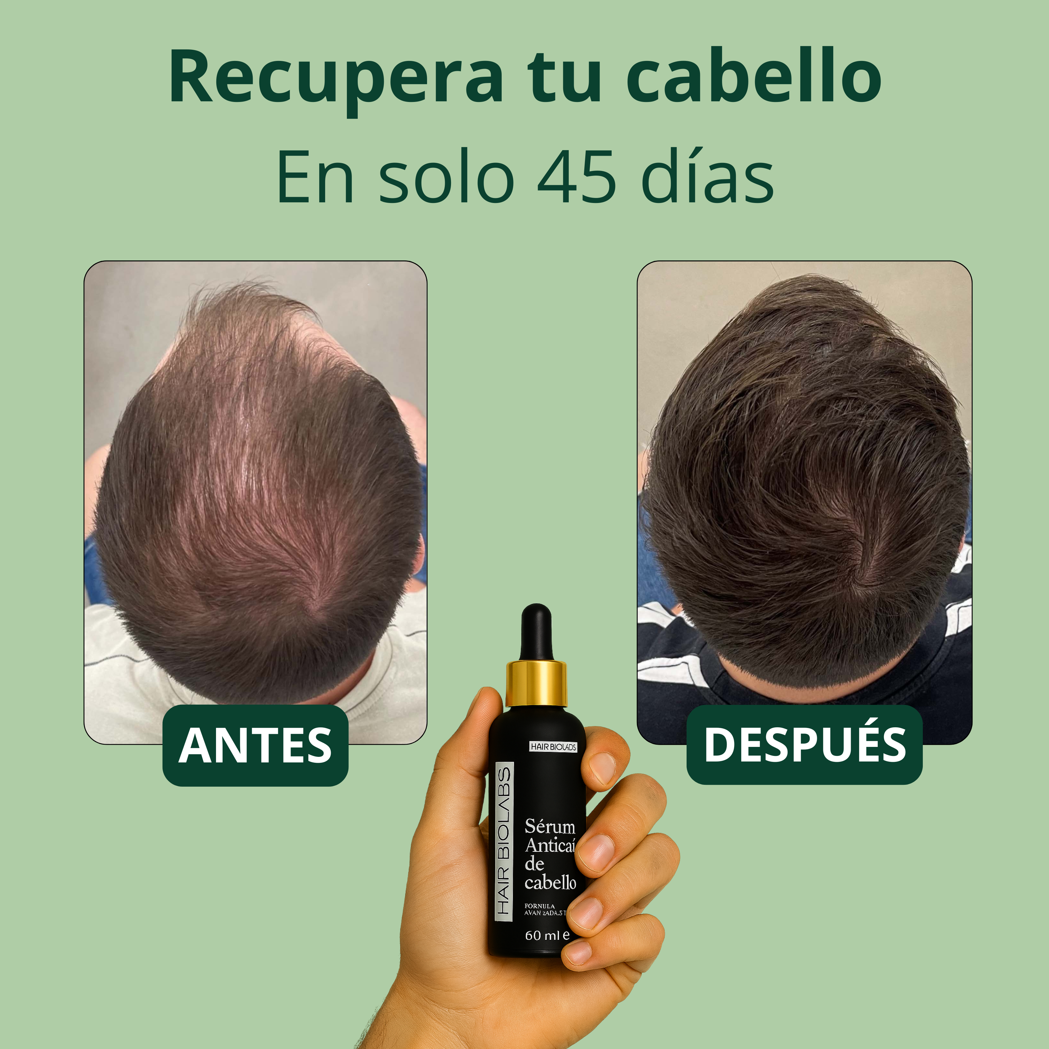 Serum Anticaída para hombre - Hair Biolabs