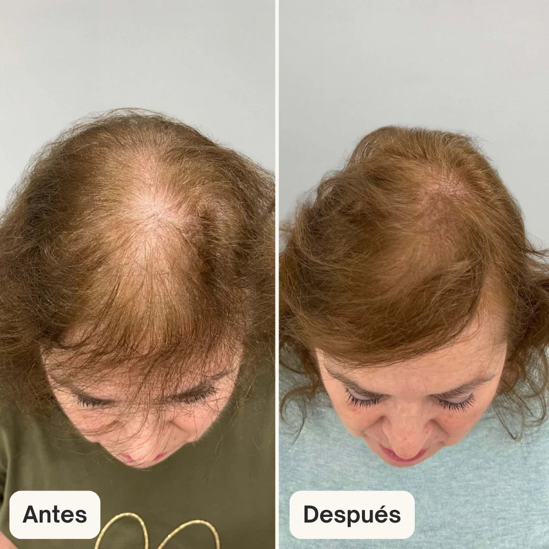 Teresa Arqueros