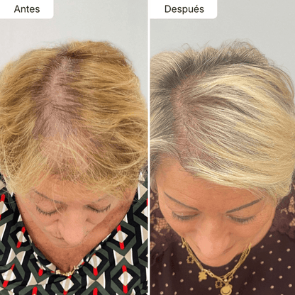 Hair Biolabs REDENSIFY™ Sérum de Triple Acción - Para la Caida en 14 dias - Hair Biolabs