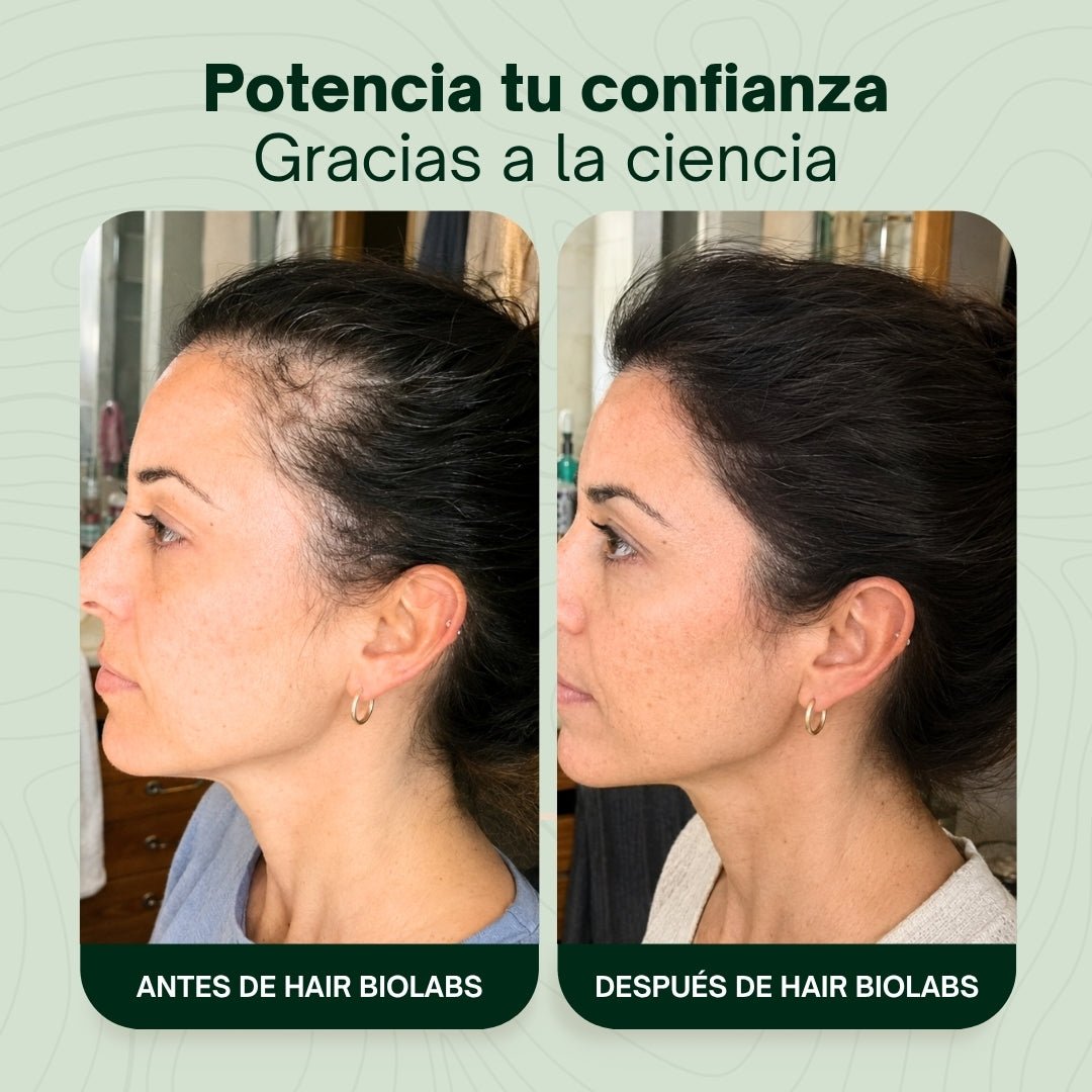 Hair Biolabs REDENSIFY™ Sérum de Triple Acción- Para la Caida en 14 dias - Hair Biolabs