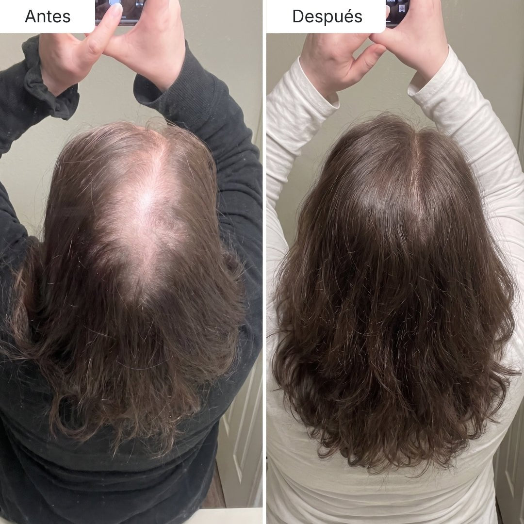 Oferta Limitada Hair Biolabs REDENSIFY™ Sérum de Triple Acción - Para la Caída en 14 dias - Hair Biolabs