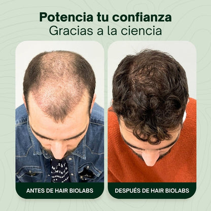 Pack completo para fortalecer y recuperar el cabello - Hair Biolabs