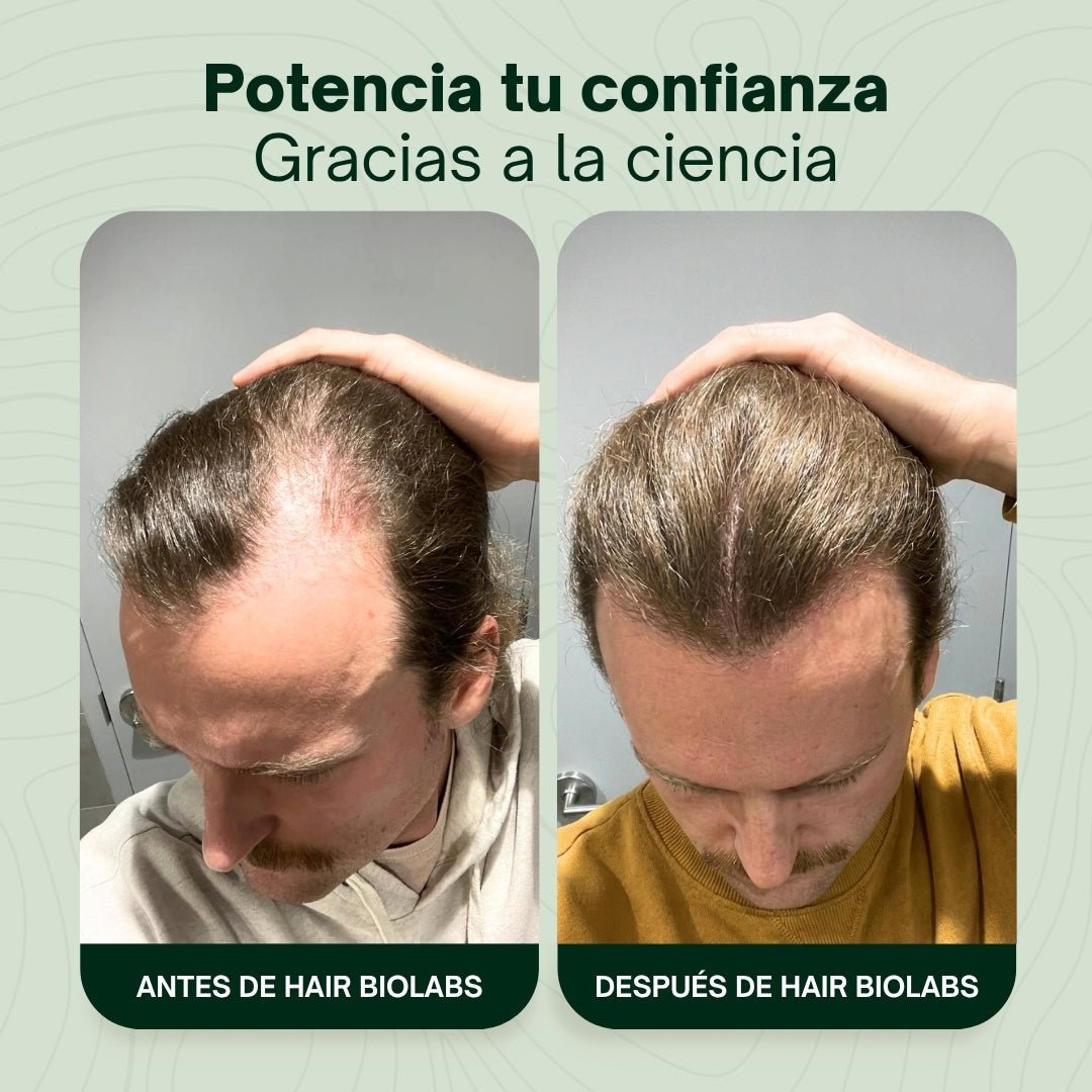 Pack completo para fortalecer y recuperar el cabello - Hair Biolabs