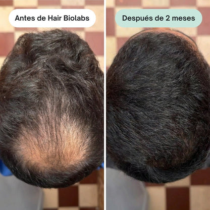 Pack completo para fortalecer y recuperar el cabello - Hair Biolabs