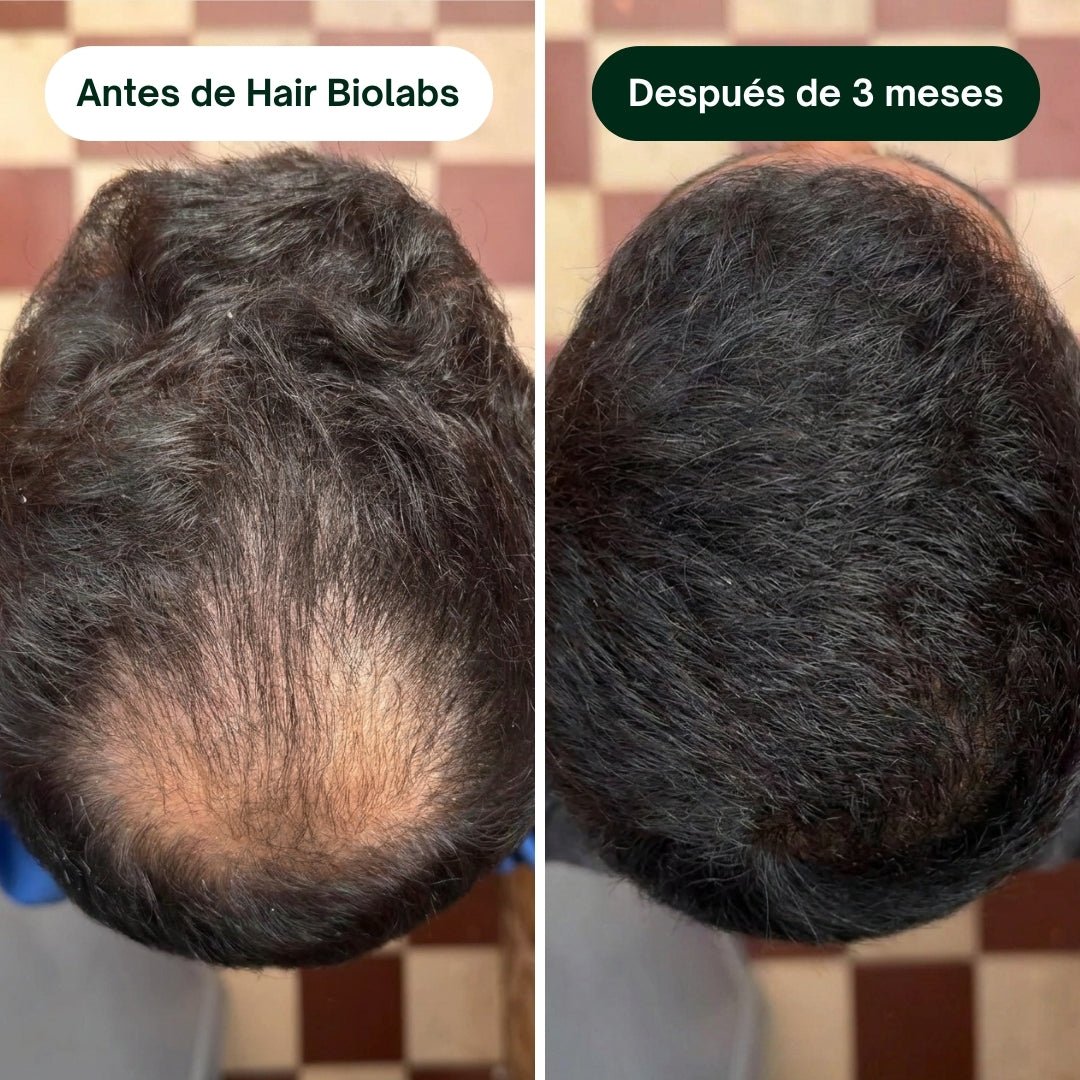 Pack completo para fortalecer y recuperar el cabello - Hair Biolabs