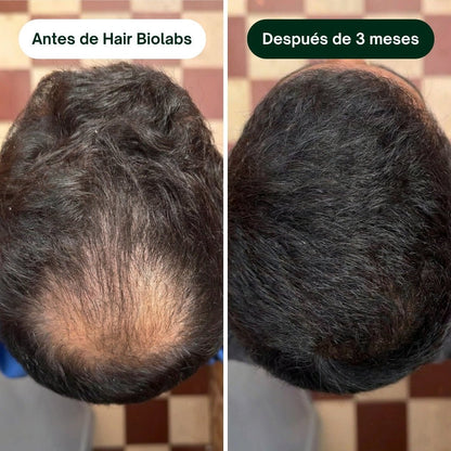 Pack completo para fortalecer y recuperar el cabello - Hair Biolabs