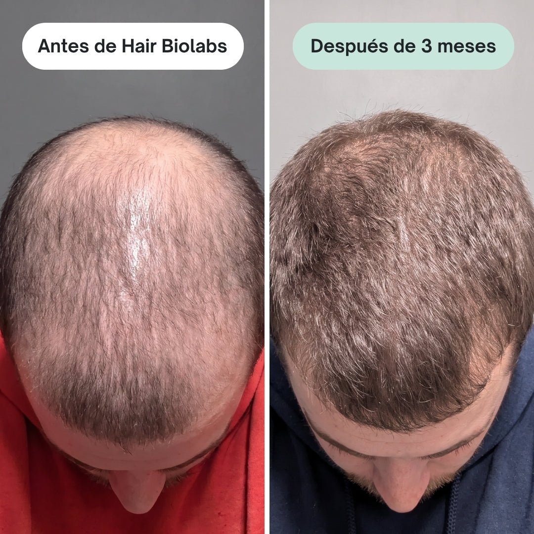 Pack completo para fortalecer y recuperar el cabello - Hair Biolabs