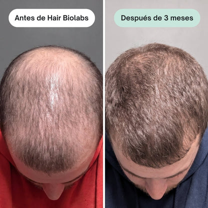 Pack completo para fortalecer y recuperar el cabello - Hair Biolabs