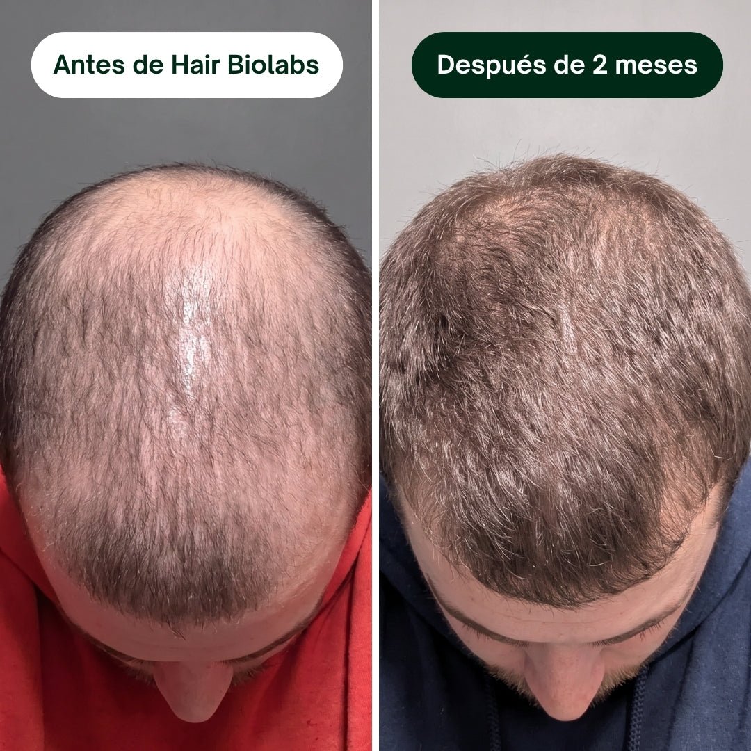 Pack completo para fortalecer y recuperar el cabello - Hair Biolabs
