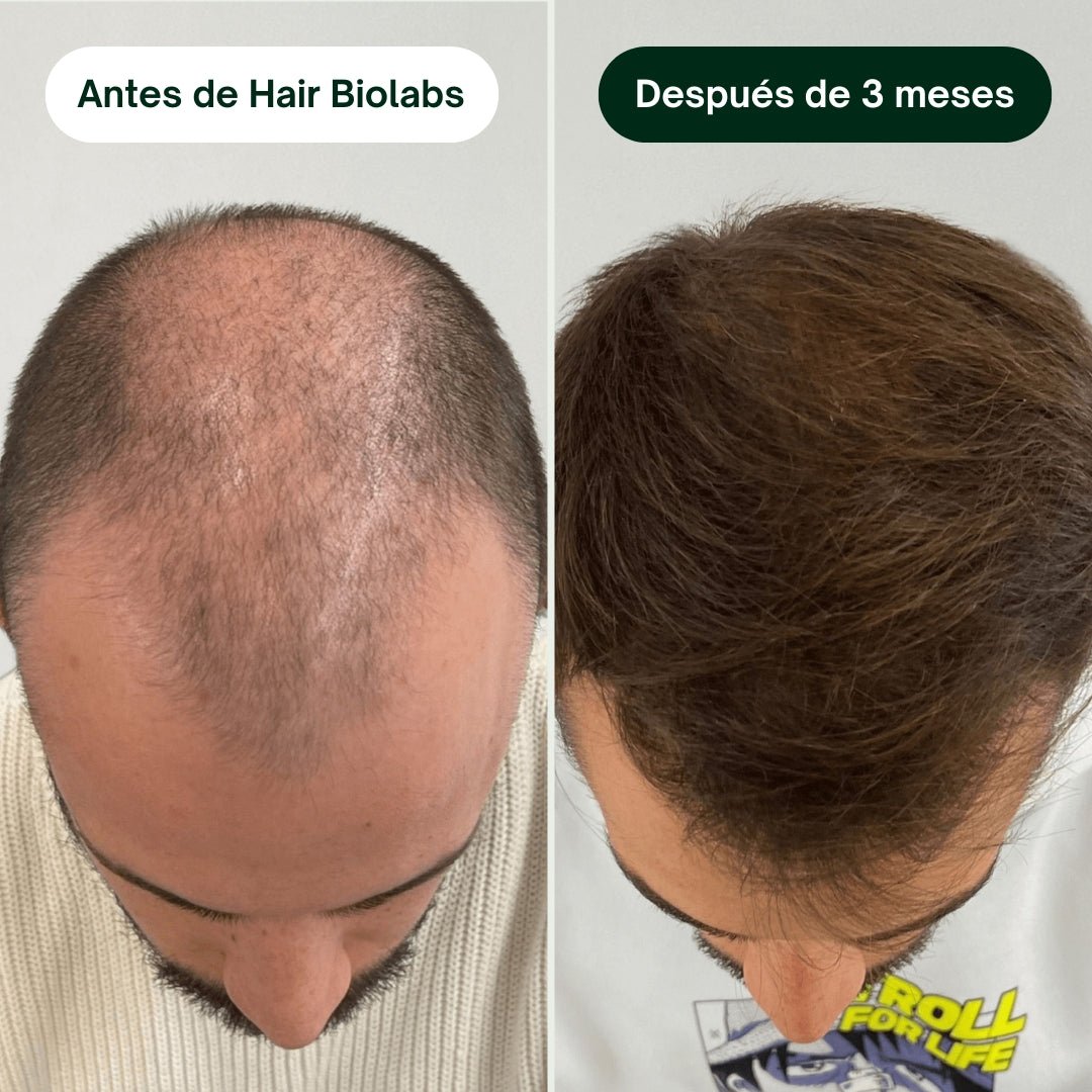 Pack completo para fortalecer y recuperar el cabello - Hair Biolabs