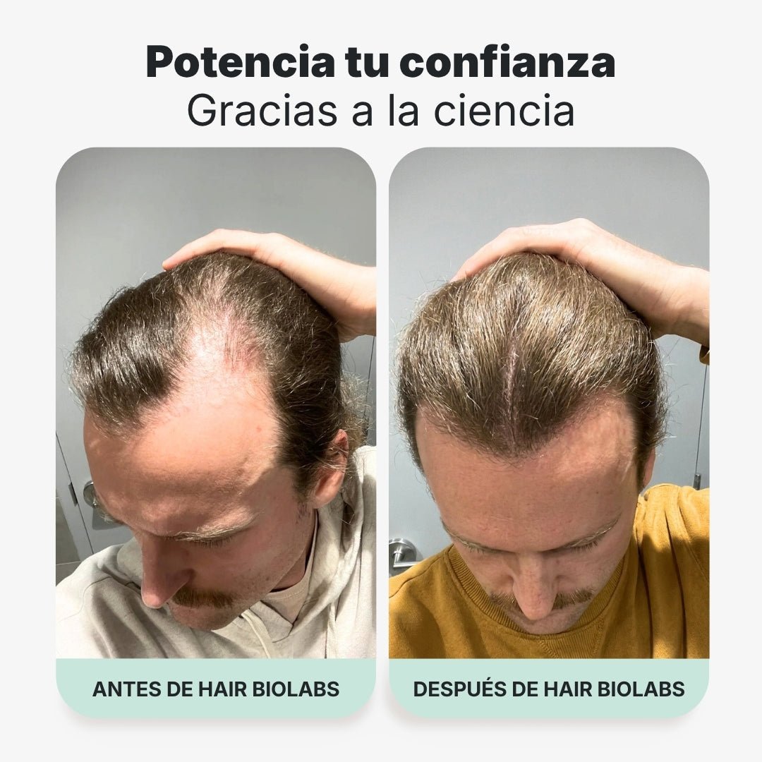 Pack completo para fortalecer y recuperar el cabello - Hair Biolabs
