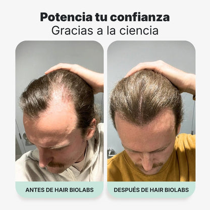 Pack completo para fortalecer y recuperar el cabello - Hair Biolabs