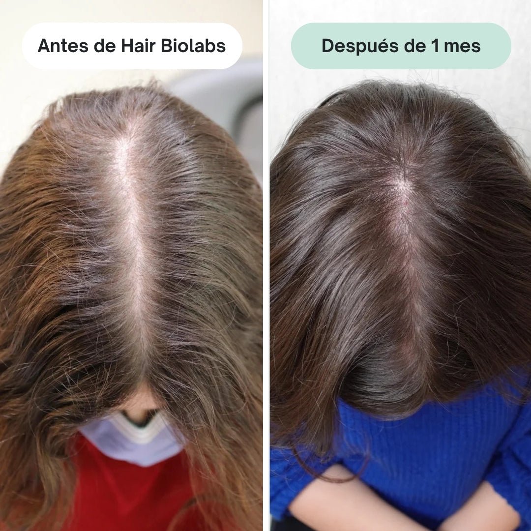 Pack completo para fortalecer y recuperar el cabello - Mujer - Hair Biolabs