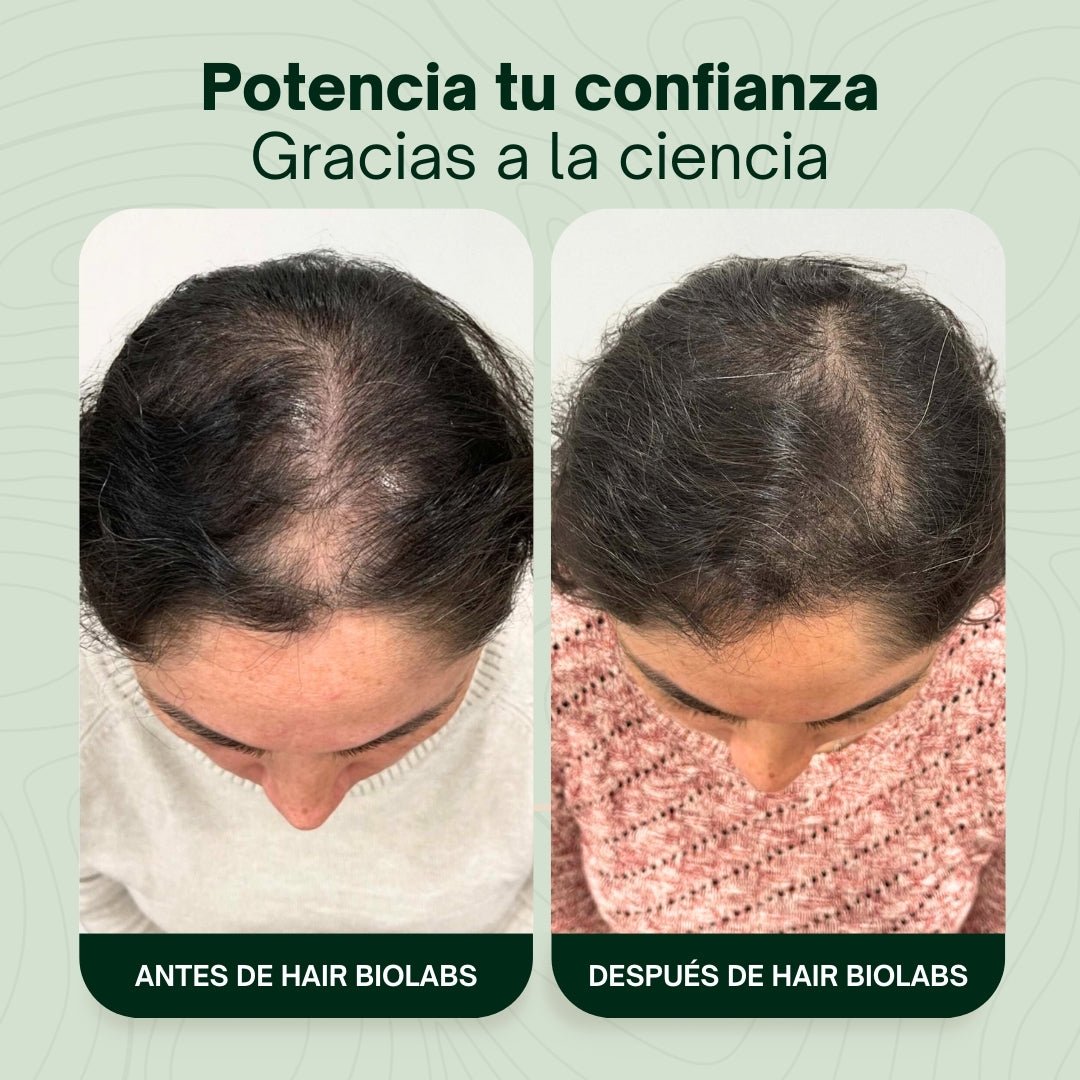 Pack completo para fortalecer y recuperar el cabello - Mujer - Hair Biolabs