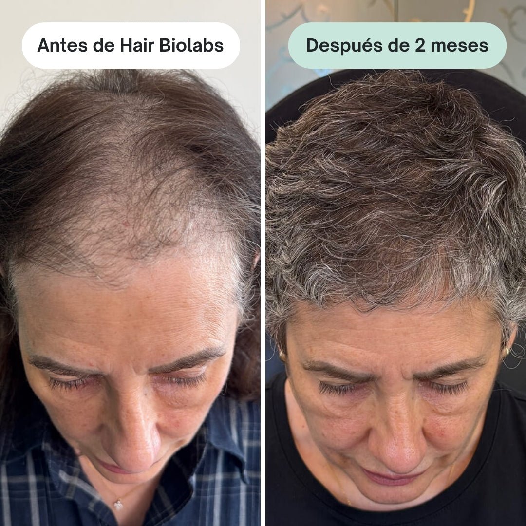 Pack completo para fortalecer y recuperar el cabello - Mujer - Hair Biolabs