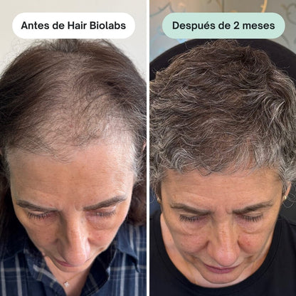 Pack completo para fortalecer y recuperar el cabello - Mujer - Hair Biolabs