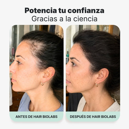 Pack completo para fortalecer y recuperar el cabello - Mujer - Hair Biolabs