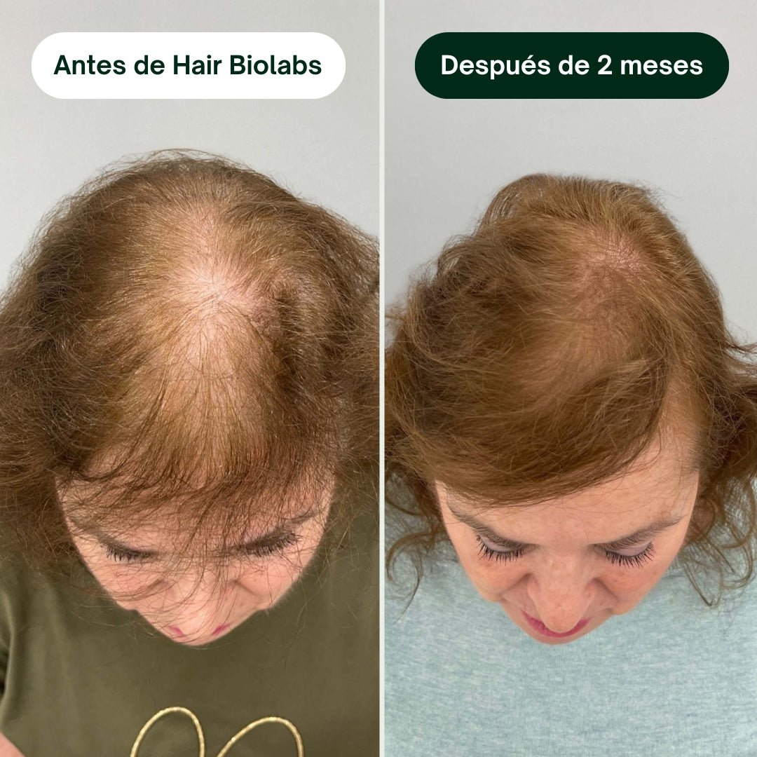 Pack completo para fortalecer y recuperar el cabello - Mujer - Hair Biolabs