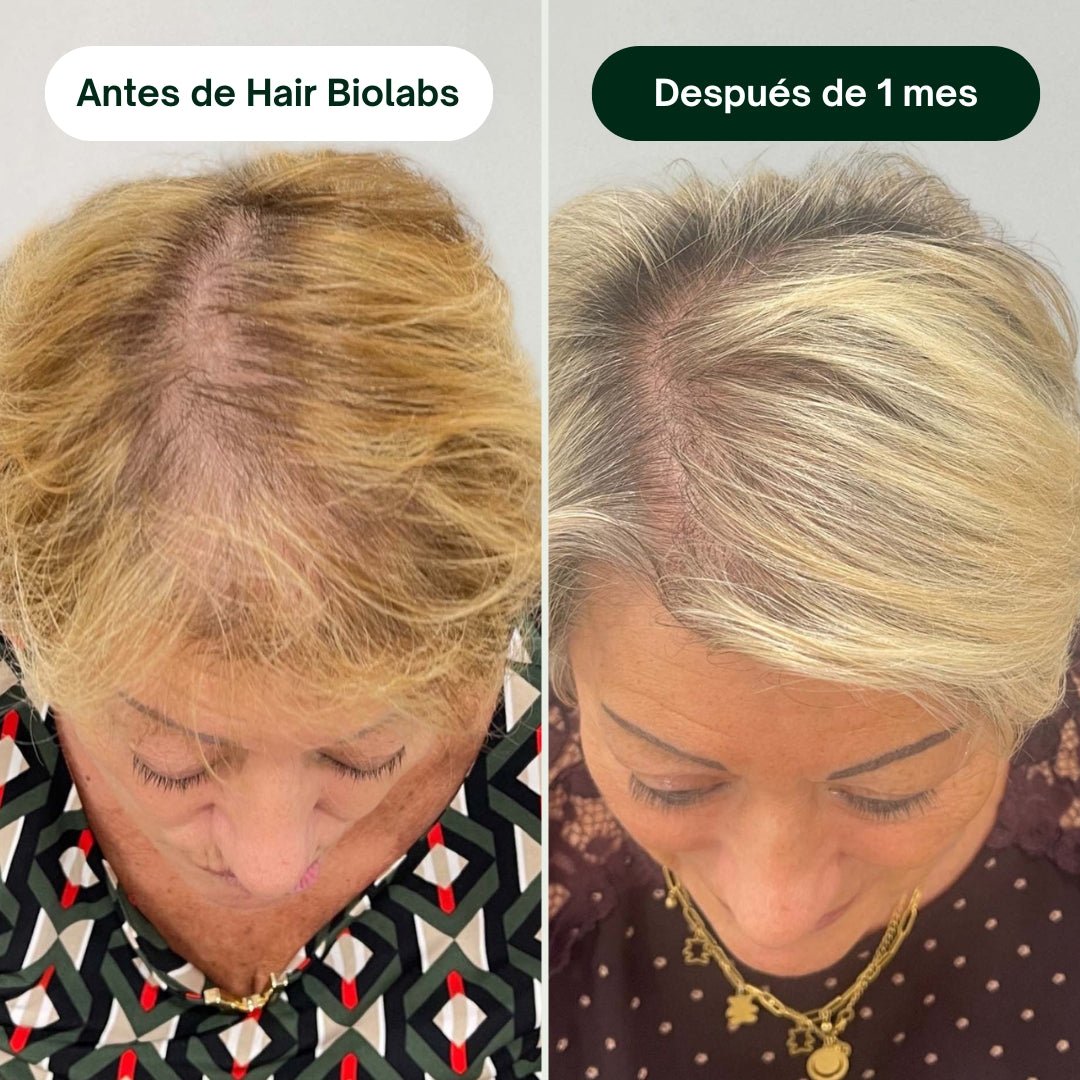 Pack completo para fortalecer y recuperar el cabello - Mujer - Hair Biolabs