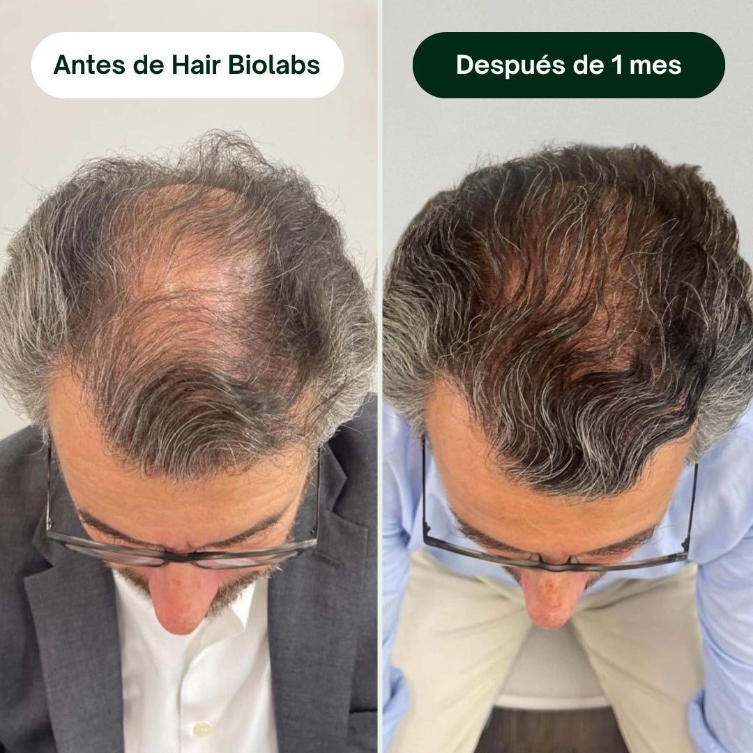 Sérum Anticaída de Doble Acción - Hair Biolabs™ - Hair Biolabs