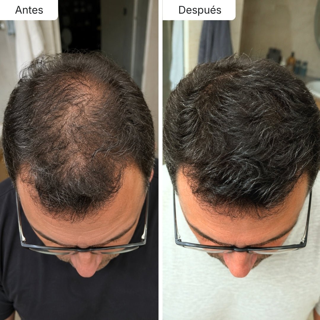 Sérum Anticaída de Doble Acción Hair Biolabs™ - Hair Biolabs