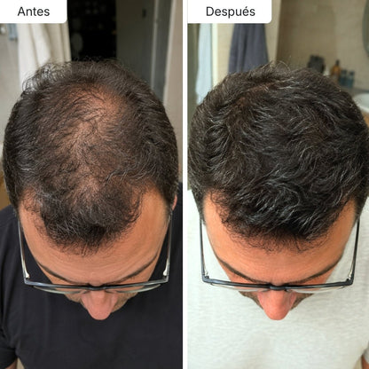 Sérum Anticaída de Doble Acción Hair Biolabs™ - Hair Biolabs