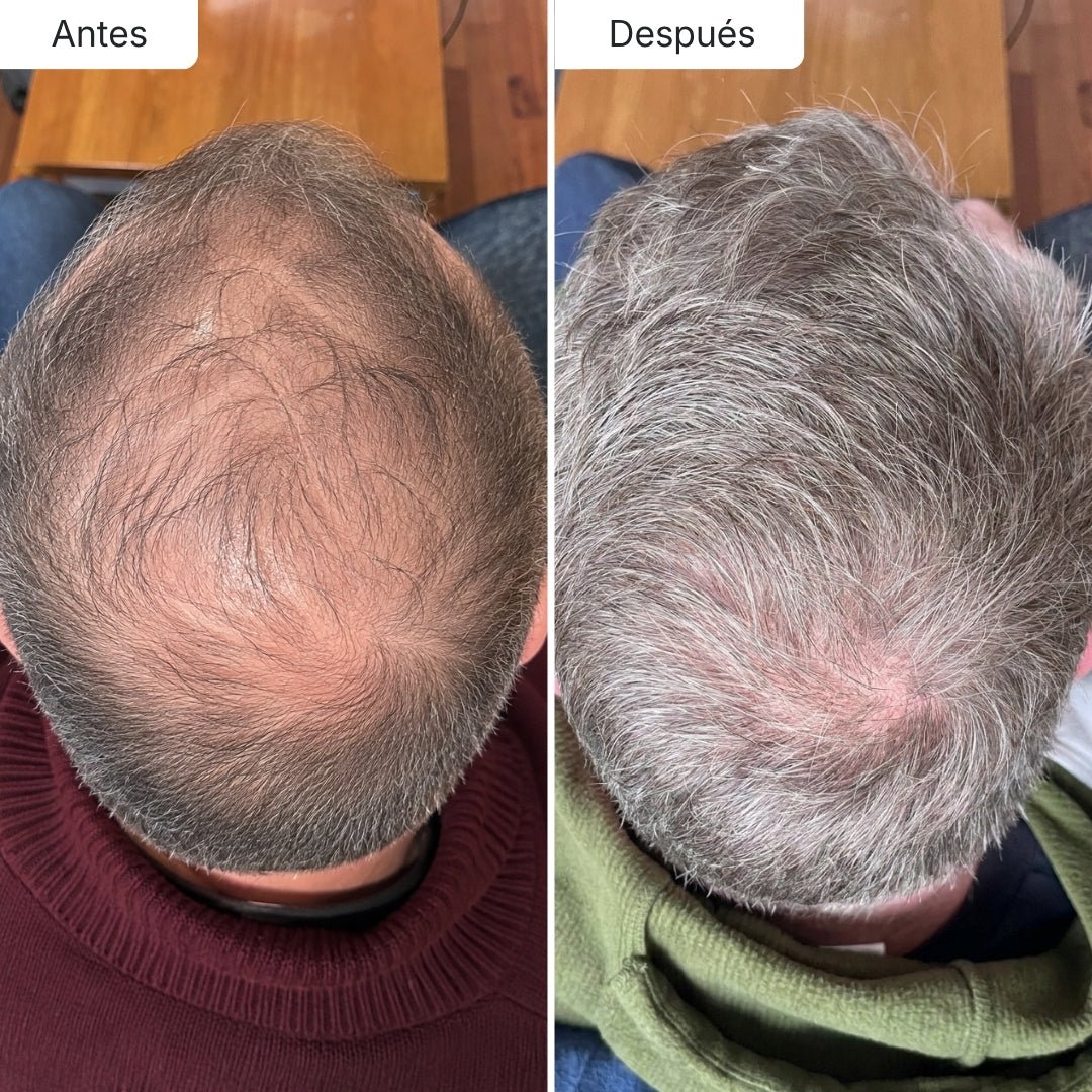 Sérum Anticaída de Doble Acción Hair Biolabs™ - Hair Biolabs