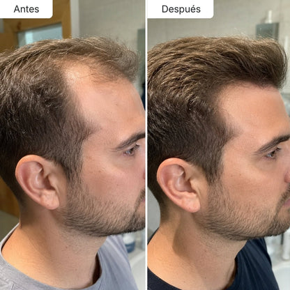 Sérum Anticaída de Doble Acción Hair Biolabs™ - Hair Biolabs