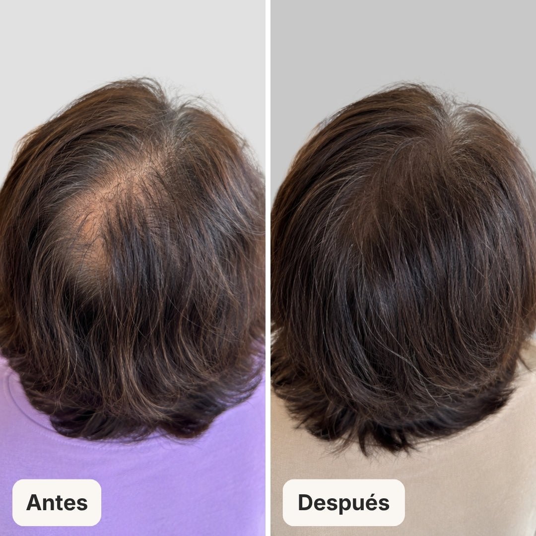 Serum Anticaída para hombres y mujeres Hair Biolabs™ - Hair Biolabs