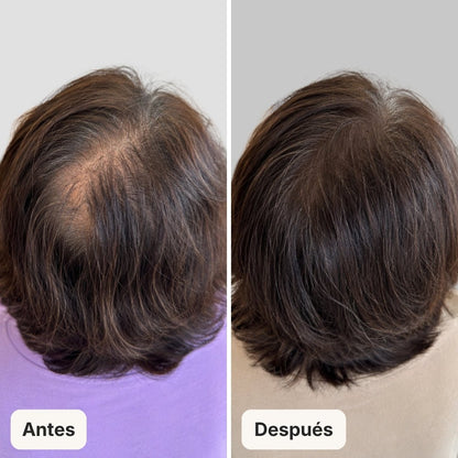 Serum Anticaída para hombres y mujeres Hair Biolabs™ - Hair Biolabs