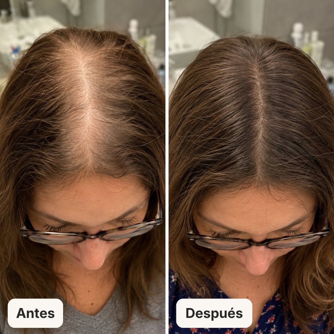 Serum Anticaída para hombres y mujeres Hair Biolabs™ - Hair Biolabs